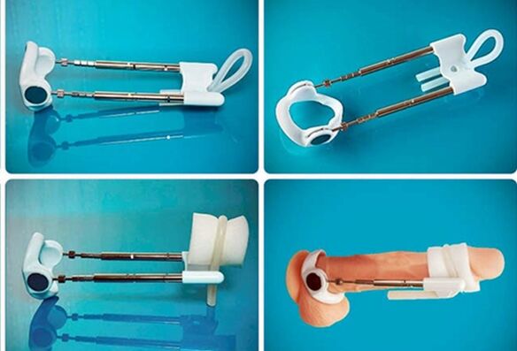 extension for penis enlargement