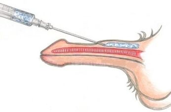 A dangerous method of penis enlargement with petroleum jelly injections
