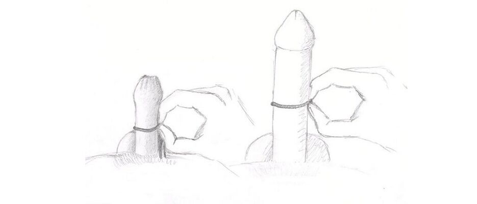 penile thickness measurement